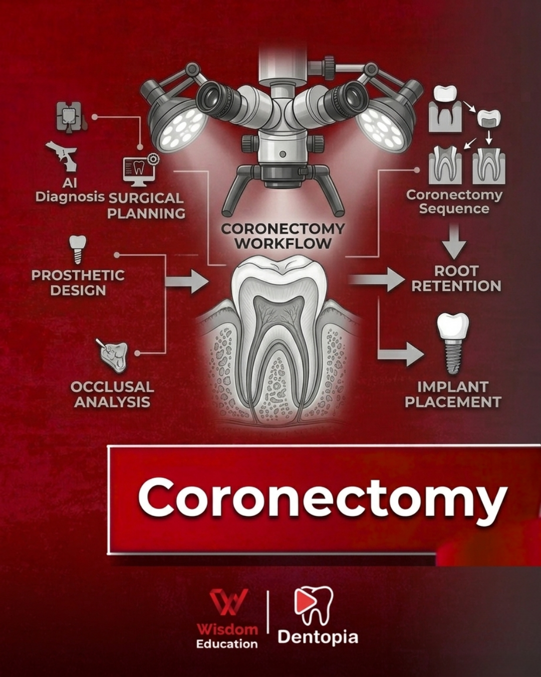 Coronectomy with Dr Mohamed Elqalla