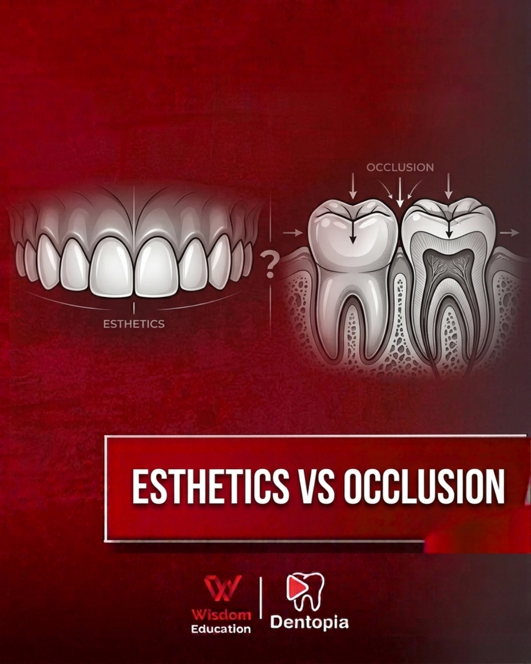 Dental Loupes 3.5x