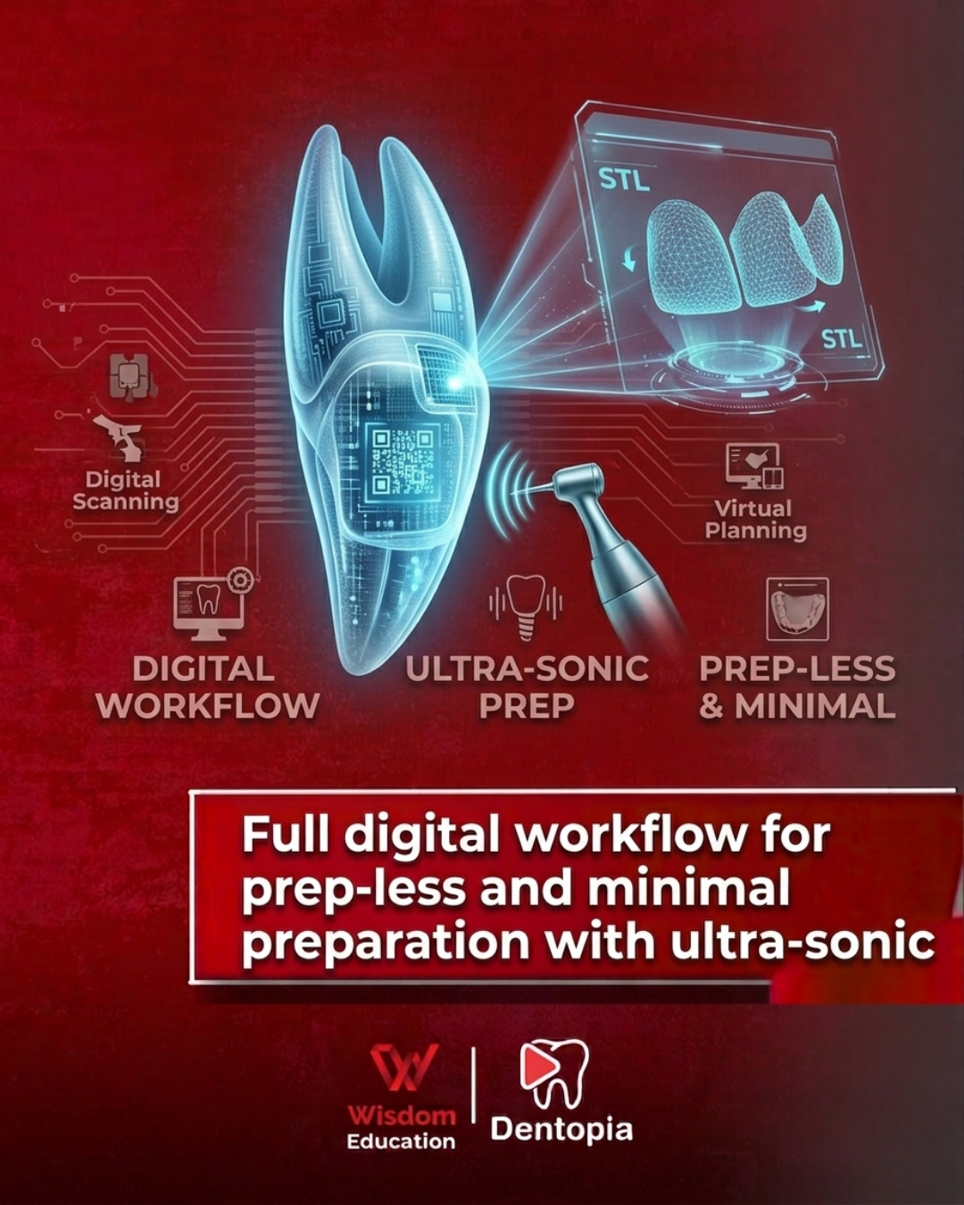 full digital workflow for prep-less and minimal preparation with ultra-sonic