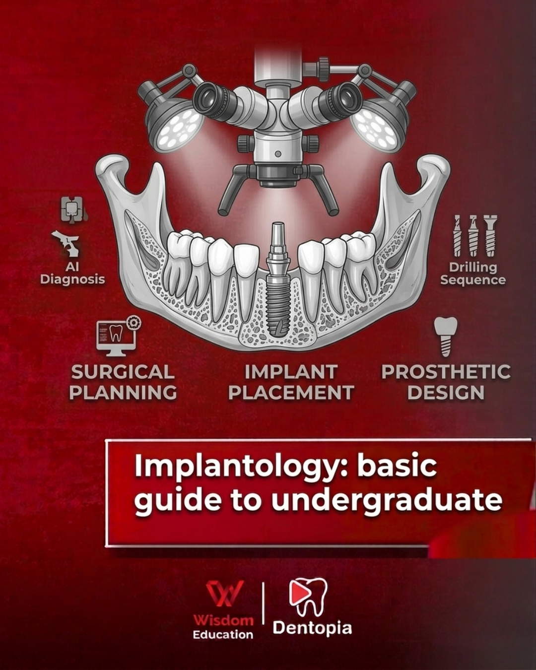 implantology: basic guide to undergraduate