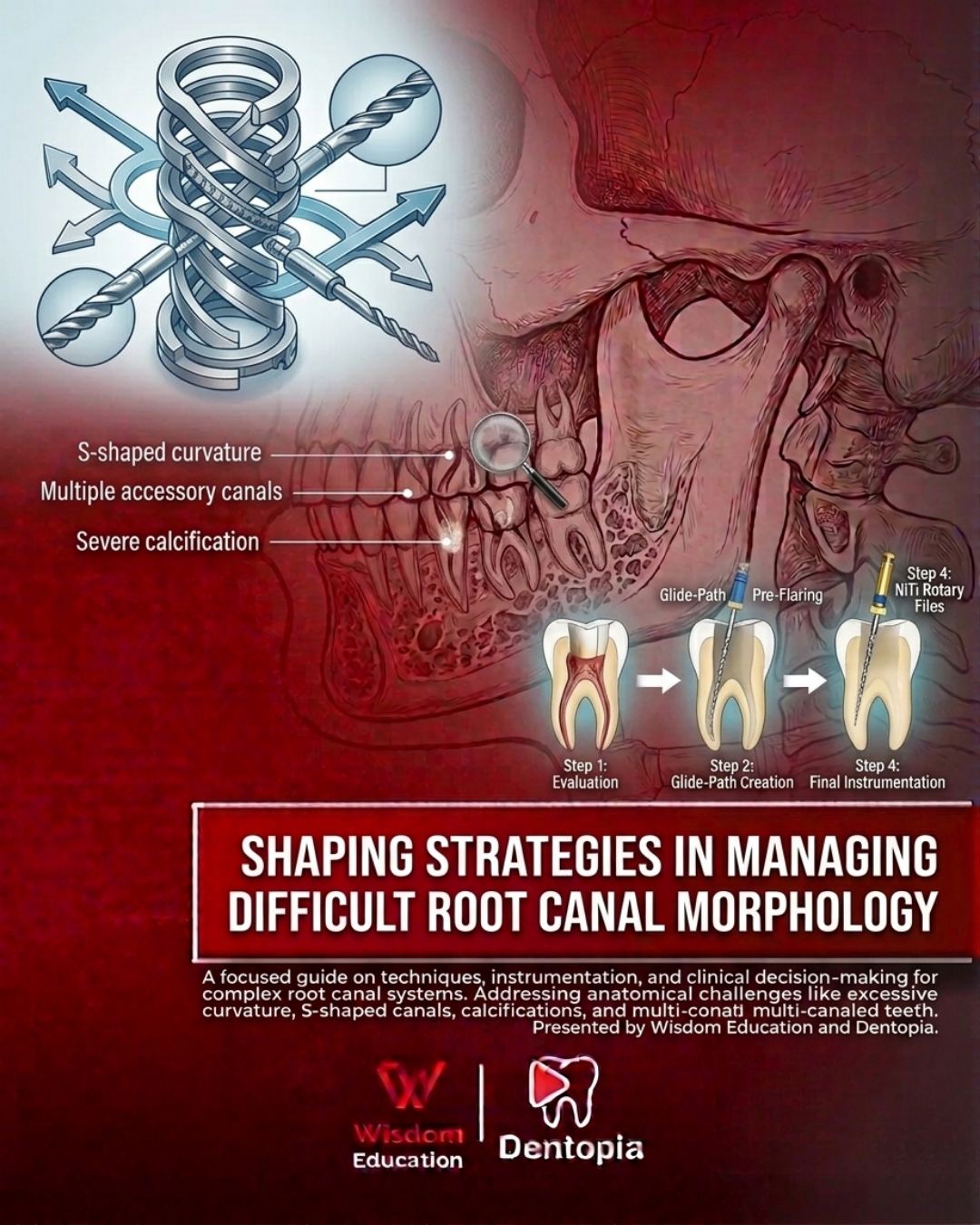 shaping strategies in manging difficult root canal morphology